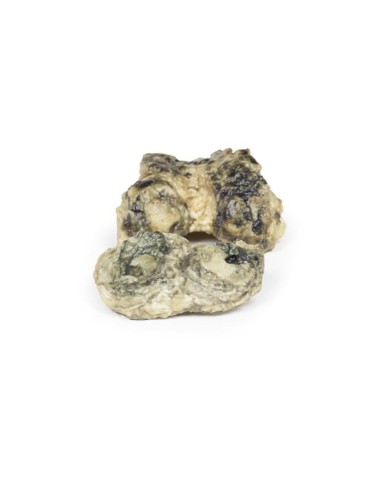 Artrite infettiva del ginocchio Erler Zimmer 3D anatomy Series MP2119