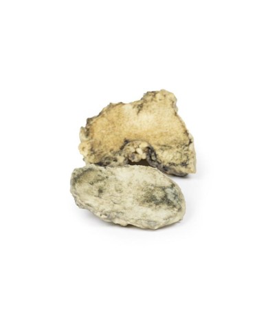 Artrite infettiva del ginocchio Erler Zimmer 3D anatomy Series MP2119