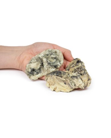 Artrite infettiva del ginocchio Erler Zimmer 3D anatomy Series MP2119