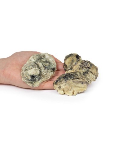 Artrite infettiva del ginocchio Erler Zimmer 3D anatomy Series MP2119