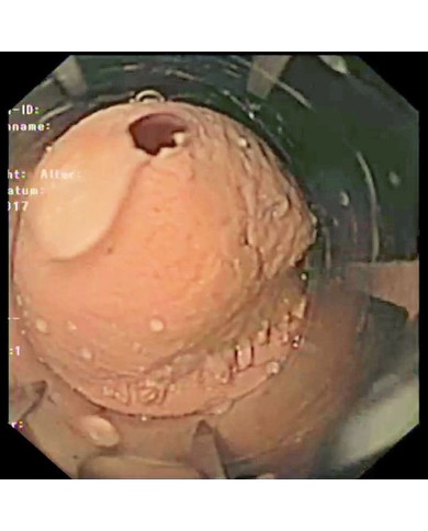 Simulatore di gastroscopia EGD EZ R21100