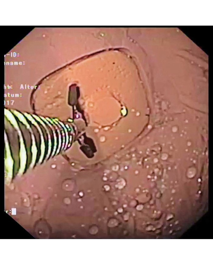 Simulatore di gastroscopia EGD EZ R21100