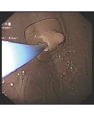 Simulatore di gastroscopia EGD EZ R21100