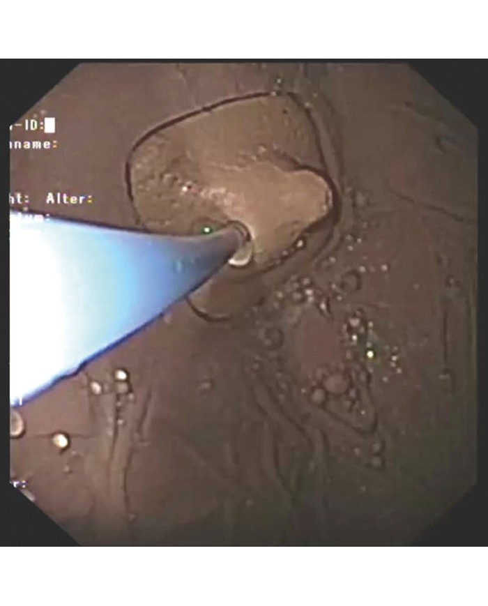 Simulatore di gastroscopia EGD EZ R21100