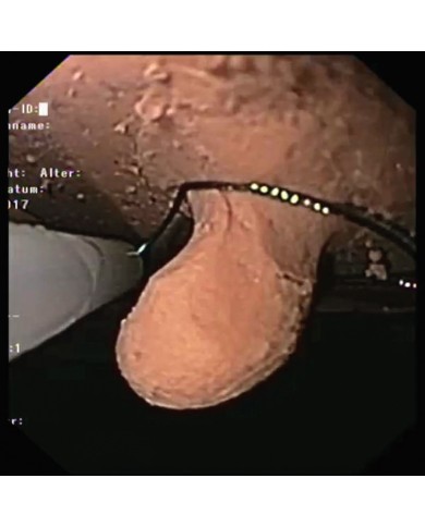 Simulatore di gastroscopia EGD EZ R21100