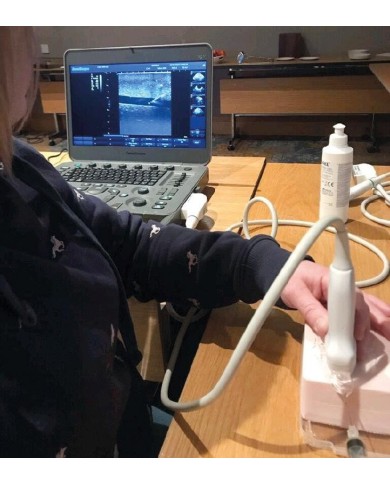 Simulatore guidato ad ultrasuoni per vaso sanguigno SonoEZ Vessel