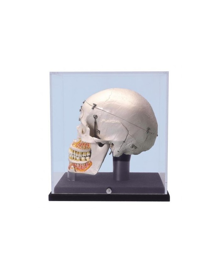 Cranio 3B Scientific, modello di lusso, per dimostrazioni, con vetrina A27/9