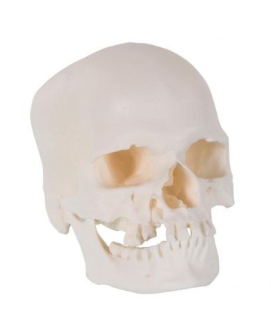 3B Scientific, Cranio microcefalo A29/1