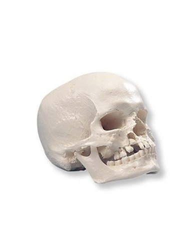 Cranio con gnatoschisi e palatoschisi, modello 3B Scientific A29/3