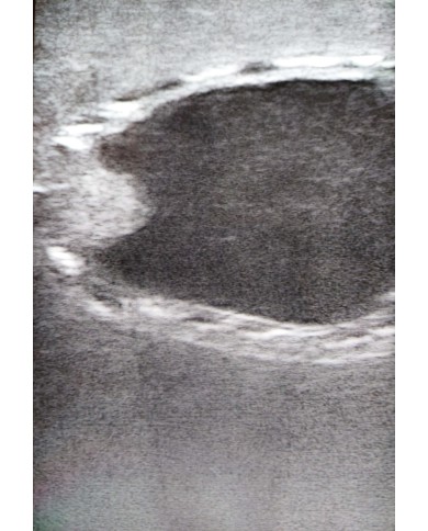 Simulatore ecografico della vescica canina Erler Zimmer VET4640