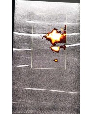 Simulatore per iniezioni sul piano fasciale SonoEZ