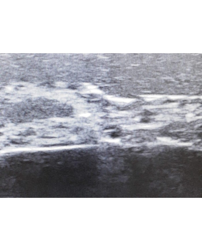 Trainer per ecografia facciale SonoEZ