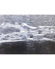 Trainer per ecografia facciale SonoEZ