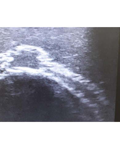 Trainer per ecografia facciale SonoEZ