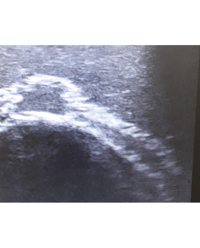 Trainer per ecografia facciale SonoEZ