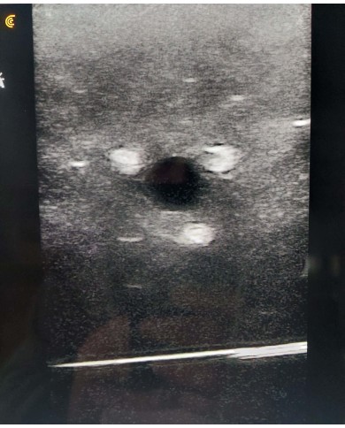 Simulatore Ecografico Anestesia regionale SonoEZ