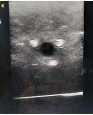 Simulatore Ecografico Anestesia regionale SonoEZ