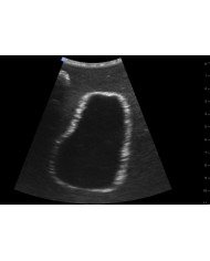 Trainer per ecografica della vescica SonoEZ