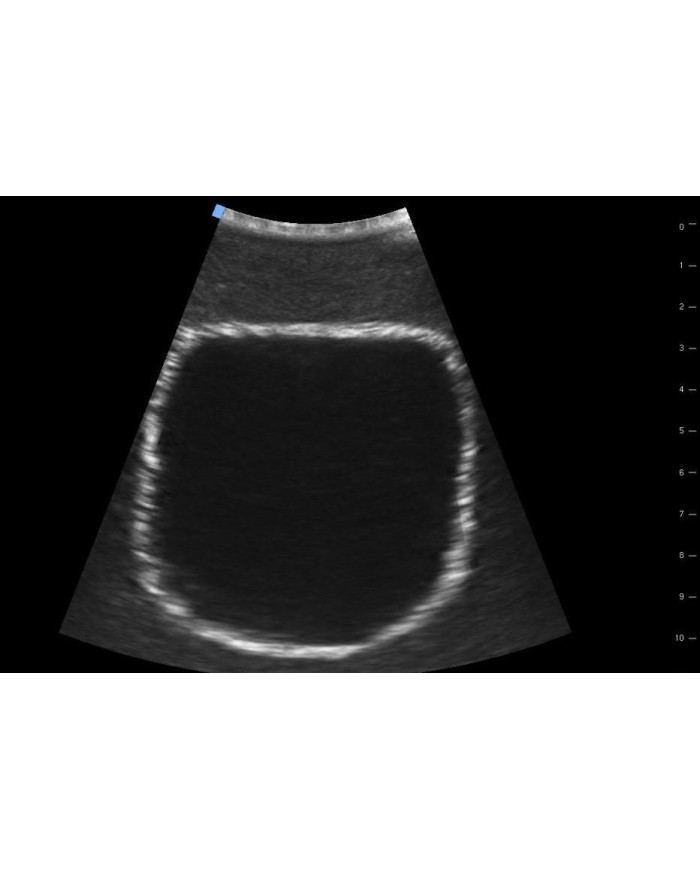 Trainer per ecografica della vescica SonoEZ
