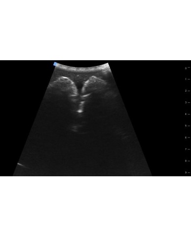 Trainer per ecografica della vescica SonoEZ