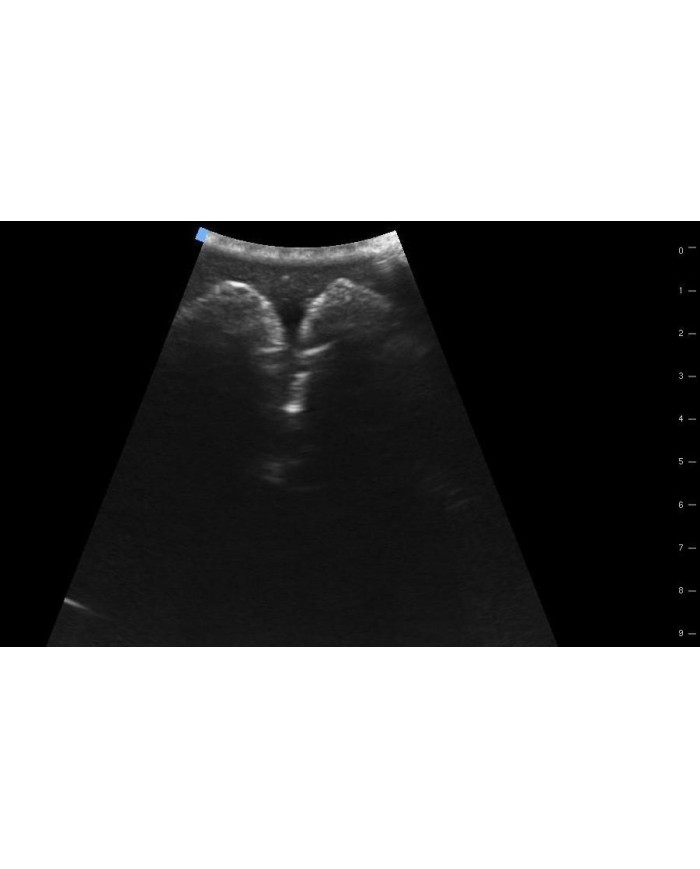 Trainer per ecografica della vescica SonoEZ