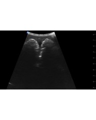 Trainer per ecografica della vescica SonoEZ