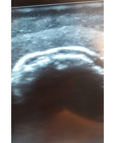 Simulatore per l ecografia dell articolazione della spalla SonoEZ