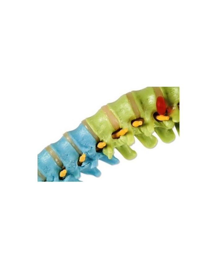 3B Scientific, Colonna vertebrale flessibile didattica a colori con tronchi del femore A58/9