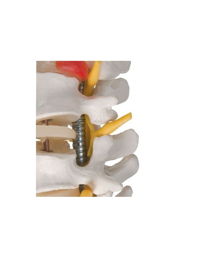 3B Scientific, Colonna vertebrale flessibile molto robusta con tronchi del femore A59/2