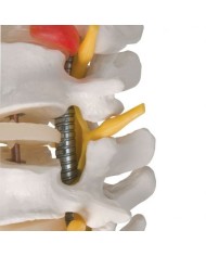 3B Scientific, Colonna vertebrale flessibile molto robusta con tronchi del femore A59/2