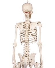 Erler Zimmer, Modello anatomico di miniatura di scheletro, Patrick