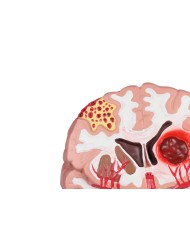 Patologie del cervello umano Erler Zimmer C711