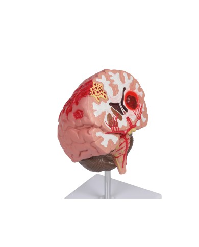 Patologie del cervello umano Erler Zimmer C711 Patologie del cervello umano Erler Zimmer C711