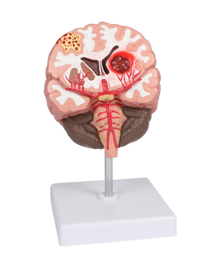 Patologie del cervello umano Erler Zimmer C711