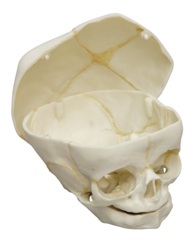 Cranio di feto di 40 settimane con calotta cranica removibile Erler Zimmer  Cranio di feto di 40 settimane con calotta cranica removibile Erler Zimmer