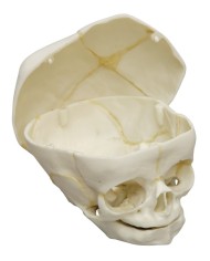 Cranio di feto di 40 settimane con calotta cranica removibile Erler Zimmer 