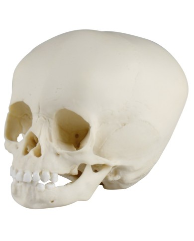 Cranio di bambino di 15 mesi Erler Zimmer 4740 Cranio di bambino di 15 mesi Erler Zimmer 4740