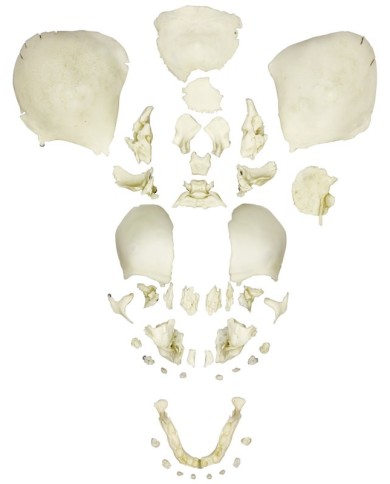Cranio di feto smontato completamente sviluppato Erler Zimmer 4728 Cranio di feto smontato completamente sviluppato Erler Zimmer 4728