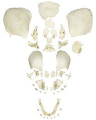 Cranio di feto smontato completamente sviluppato Erler Zimmer 4728