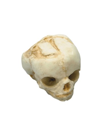 Kit completo Collezione di crani di feto da 13 settimane a 40 settimane Erl