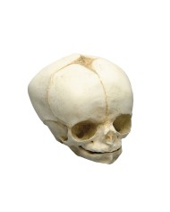 Kit completo Collezione di crani di feto da 13 settimane a 40 settimane Erl