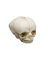 Kit completo Collezione di crani di feto da 13 settimane a 40 settimane Erl