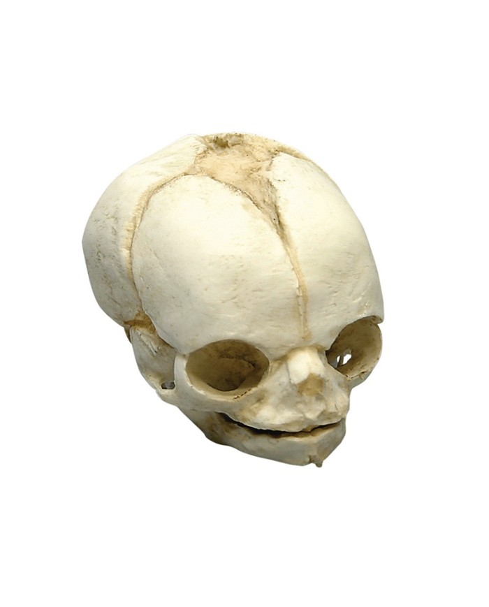 Kit completo Collezione di crani di feto da 13 settimane a 40 settimane Erl