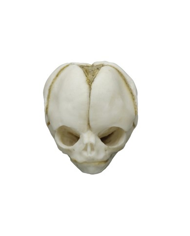 Kit completo Collezione di crani di feto da 13 settimane a 40 settimane Erl