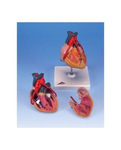 3B Scientific, Cuore, modello classico, con bypass, scomponibile in 2 parti G05 3B Scientific, Cuore, modello classico, con bypass, scomponibile in 2 parti G05