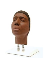 Simulatore per iniezioni facciali Modello C Erler Zimmer 8120