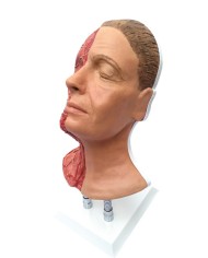 Simulatore per iniezioni facciali con muscolatura arterie e nervi Erler Zi
