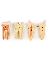 Modello anatomico di mascella inferiore scomponibile in 6 parti Erler Zimm