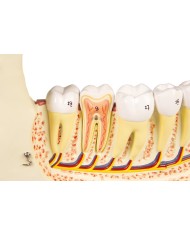 Modello anatomico di mascella inferiore scomponibile in 6 parti Erler Zimm