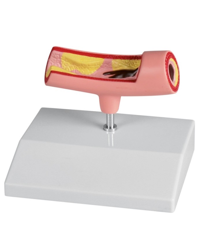 Erler Zimmer modello anatomico di arteria G241